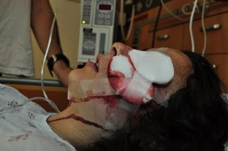 Le gouvernement israélien refuse d’assumer les soins d’une jeune americaine blessée par ses forces