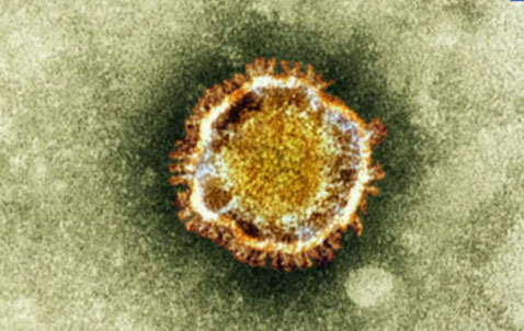 Arabie : nouveau décès d’un malade atteint du coronavirus
