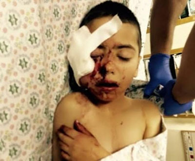 Un soldat israélien tire sur un enfant de 5 ans, et le défigure