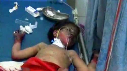 «La fermeté» des Al-Saoud contre les enfants du Yémen (photos)
