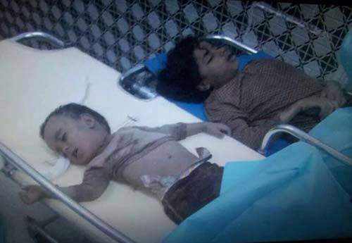 «La fermeté» des Al-Saoud contre les enfants du Yémen. «La fermeté» des Al-Saoud contre les enfants du Yémen (photos)