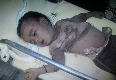 L’Arabie poursuit son agression contre le Yémen, près de 40 martyrs
