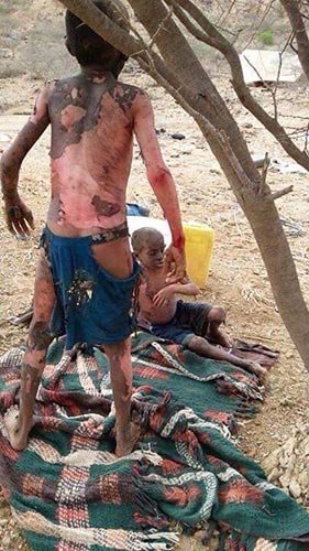 La cruauté des Saoud dépasse toutes les limites