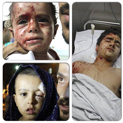 Guerre à Gaza: la majorité des blessés encore traités sont des enfants
