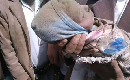 Yémen: l’Arabie continue de violer la trêve, des dizaines de martyrs
