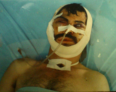 Azzirarieh : la confrontation et le massacre