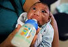 Zika: 583 cas de microcéphalie confirmés au Brésil