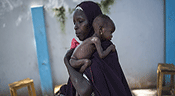 1,4 million d’enfants risquent de mourir de la famine dans 4 pays (UNICEF)

