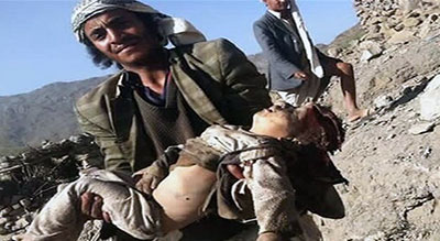 Le nombre d’enfants tués au Yémen est sans précédent

