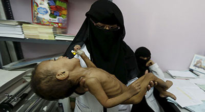 Yémen: guerre sous silence et crise humanitaire

