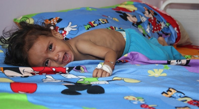 Selon l’Onu, le Yémen est au bord d’une catastrophe humanitaire