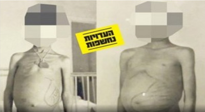 «Israël» a exposé des enfants yéménites enlevés à des essais scientifiques
