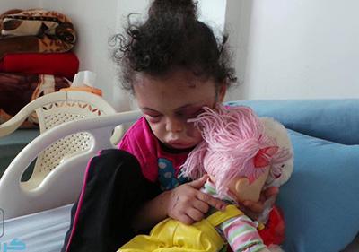 Yémen: Après un bombardement saoudien, une petite fille est la seule survivante d’une famille