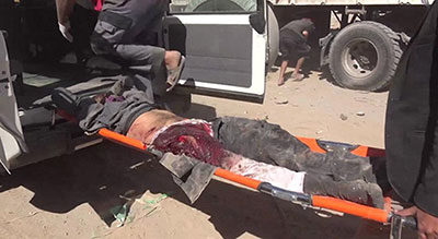 Yémen: 84 martyrs et blessés dans 3 attaques de l’aviation saoudienne
