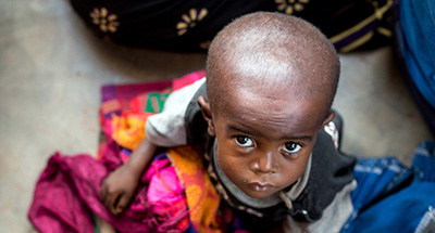 Deux millions d’enfants menacés par la malnutrition en RD Congo