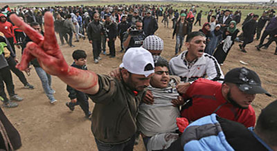 Gaza: Un Palestinien blessé vendredi décède, portant à 17 le nombre de martyrs


