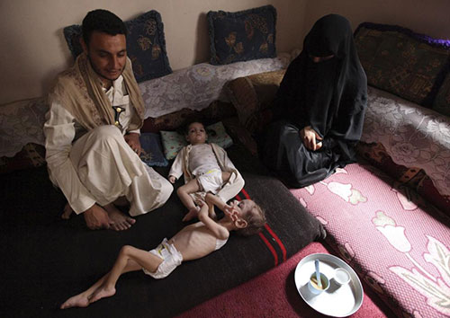 L’Arabie pousse le Yémen au bord de la famine (photos)