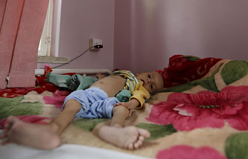 L’Arabie pousse le Yémen au bord de la famine (photos)