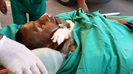 Le père du bébé palestinien brûlé vif succombe à ses blessures
