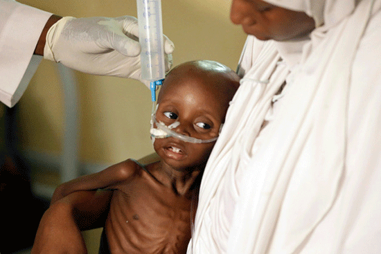 Nigéria : 75 000 enfants menacés de famine imminente selon l'ONU