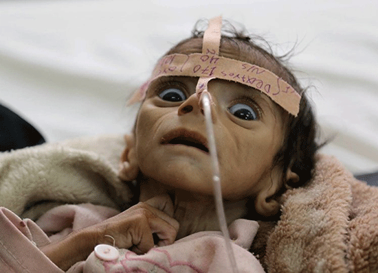 Offensive au Yémen: l’ONU épingle la coalition arabe pour les morts d’enfants

