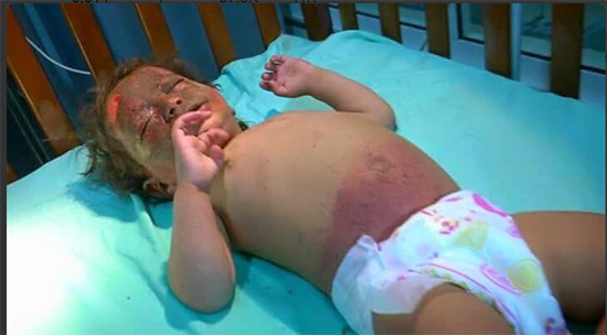 Nouveau massacre saoudien au Yémen: 8 femmes et un enfant tombés en martyre (photos)

