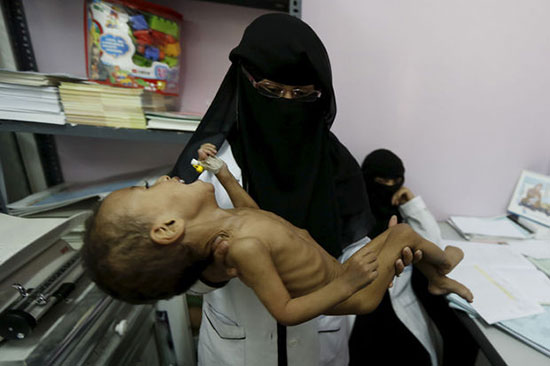 Yémen: guerre sous silence et crise humanitaire