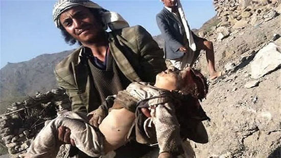 Le nombre d’enfants tués au Yémen est sans précédent

