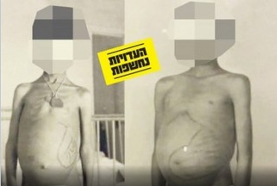 «Israël» a exposé des enfants yéménites enlevés à des essais scientifiques