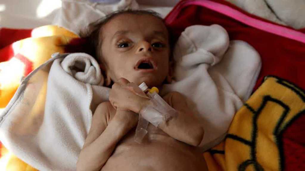 Yémen: L’ONU dit perdre «le combat contre la famine»