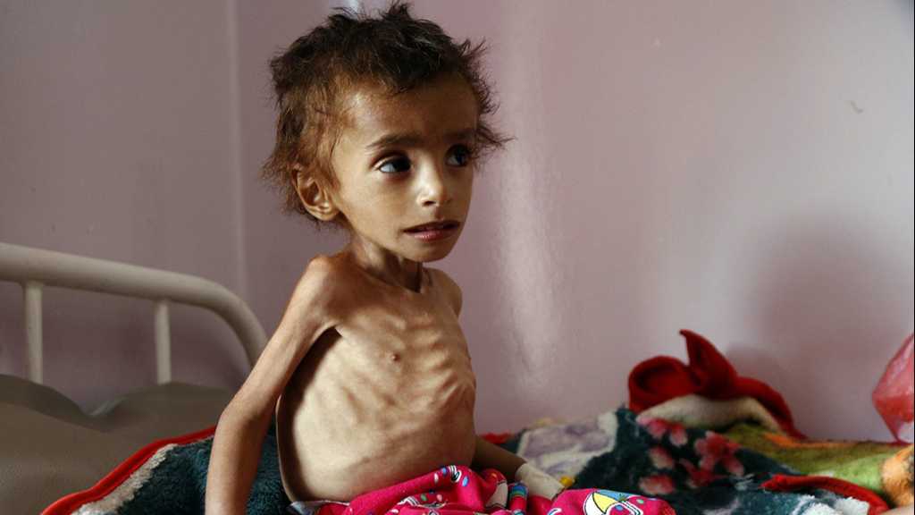 12 millions de yéménites pourraient se trouver au bord de la famine au cours des prochains mois (ONU)