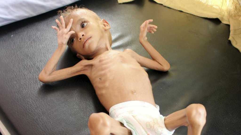 Le NYT publie des photos d’enfants mourant de faim au Yémen, Facebook les censure temporairement