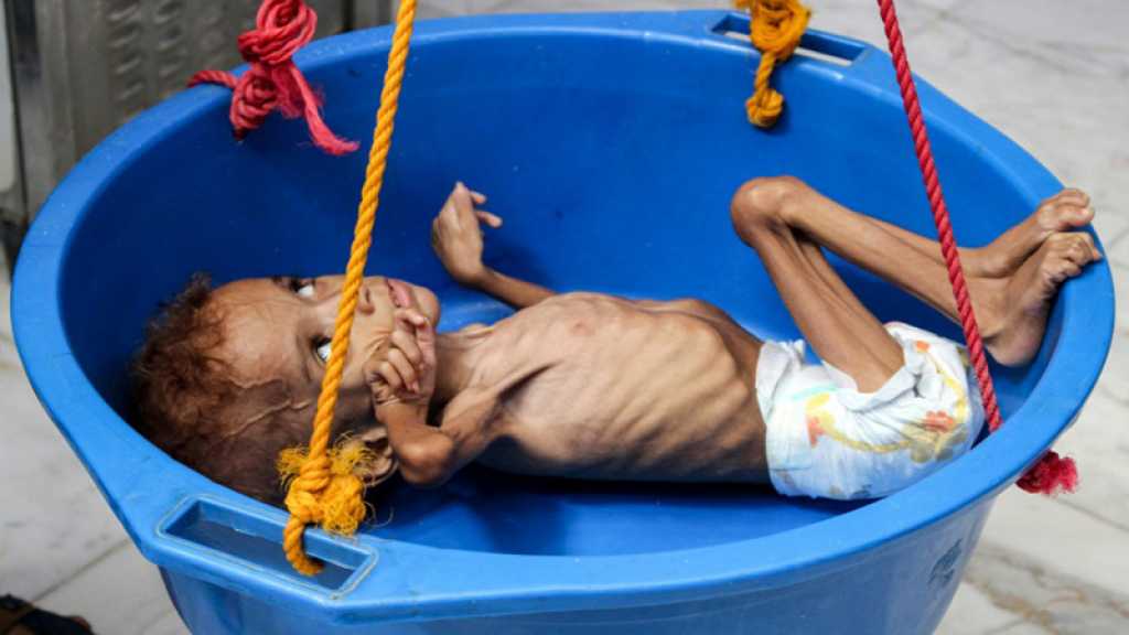 L’urgence alimentaire pourrait concerner 20 millions de Yéménites
