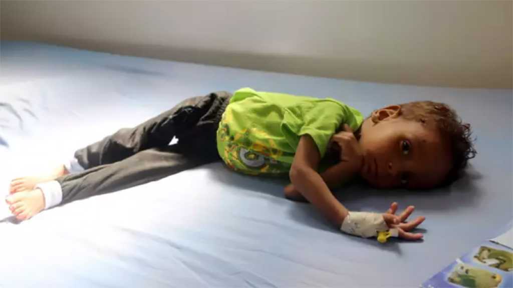 Yémen: Des millions d’enfants sont au bord de la famine selon l’Unicef