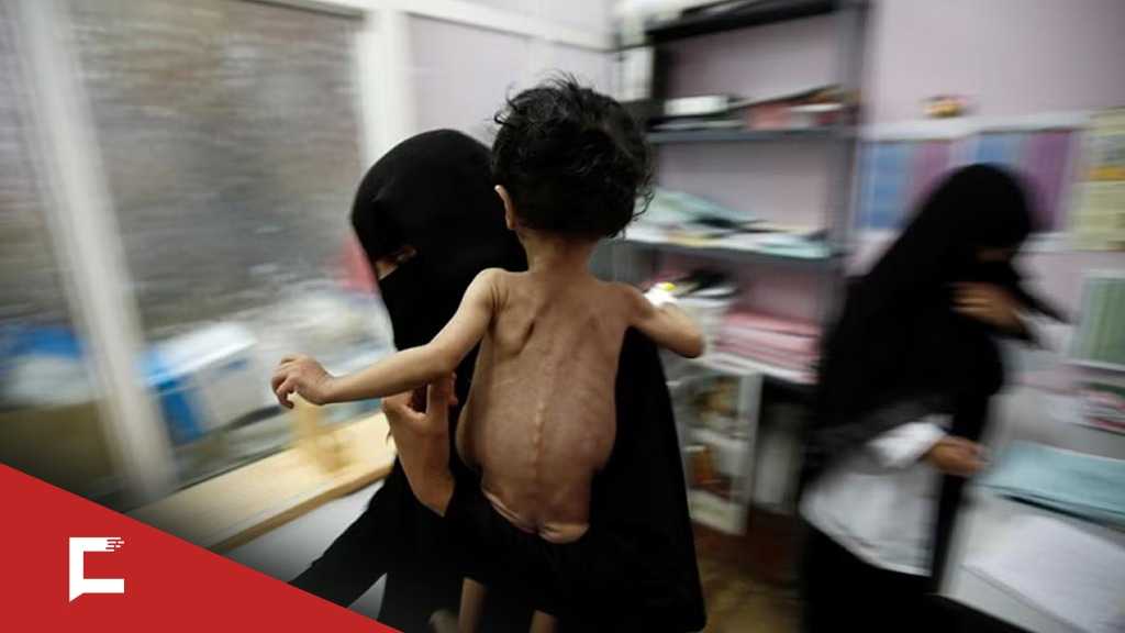 La crise du cancer au Yémen après 12 ans de blocus et d’agression saoudiens