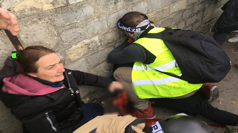 «#Gilets_jaunes»: un manifestant a eu une main arrachée lors de l'acte 13 à #Paris